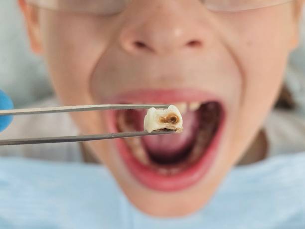 Best Emergency Treatment for Toothache in San Ysidro, NM